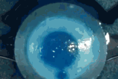 Một cơ quan giả bắt chước những gì xảy ra trong một cái chớp mắt