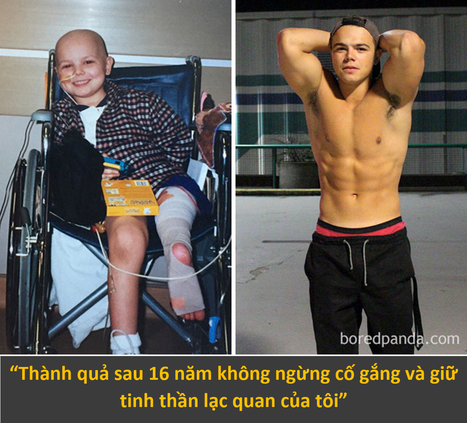 Màn lột xác ngoạn mục của những con người chiến thắng ung thư - 9 Màn lột xác ngoạn mục của những con người chiến thắng ung thư - 9