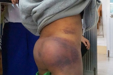 Vụ 4 học sinh bị người thân bạo hành: Không khởi tố vụ án