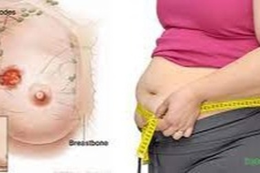 Đừng tẩm bổ sau điều trị ung thư vú