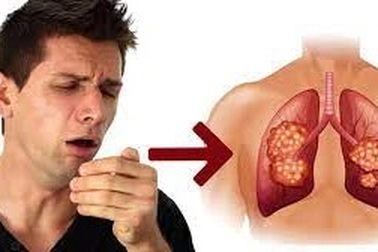 8 dấu hiệu báo động nguy cơ ung thư