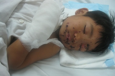 “Mẹ ơi, liệu con có còn được thấy ánh mặt trời ?”