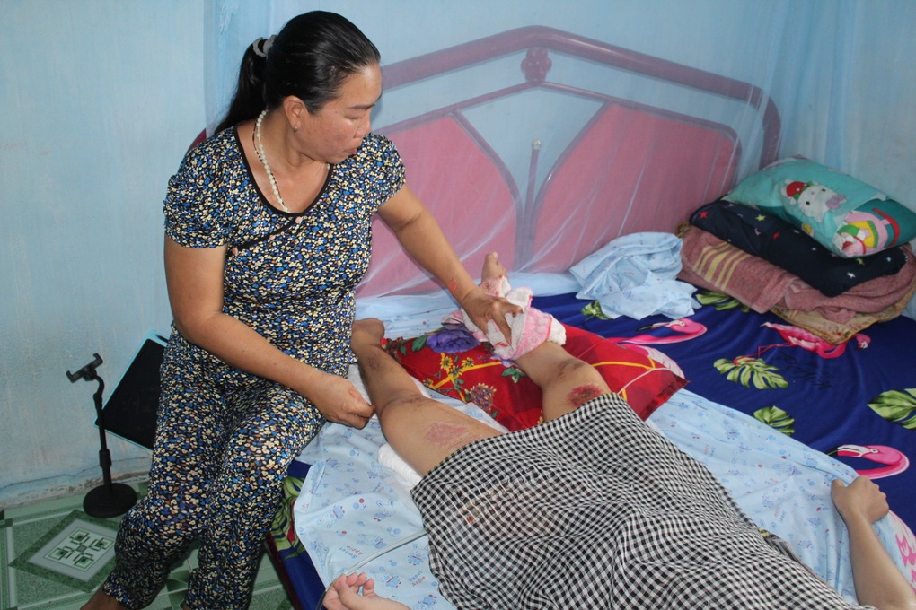 Cô gái xinh đẹp tan nát ước mơ dưới bánh xe khách - 4