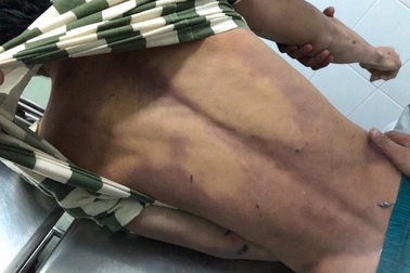 Gia đình thanh niên bị bạn tù đánh chết yêu cầu khởi tố cán bộ nhà tạm giữ