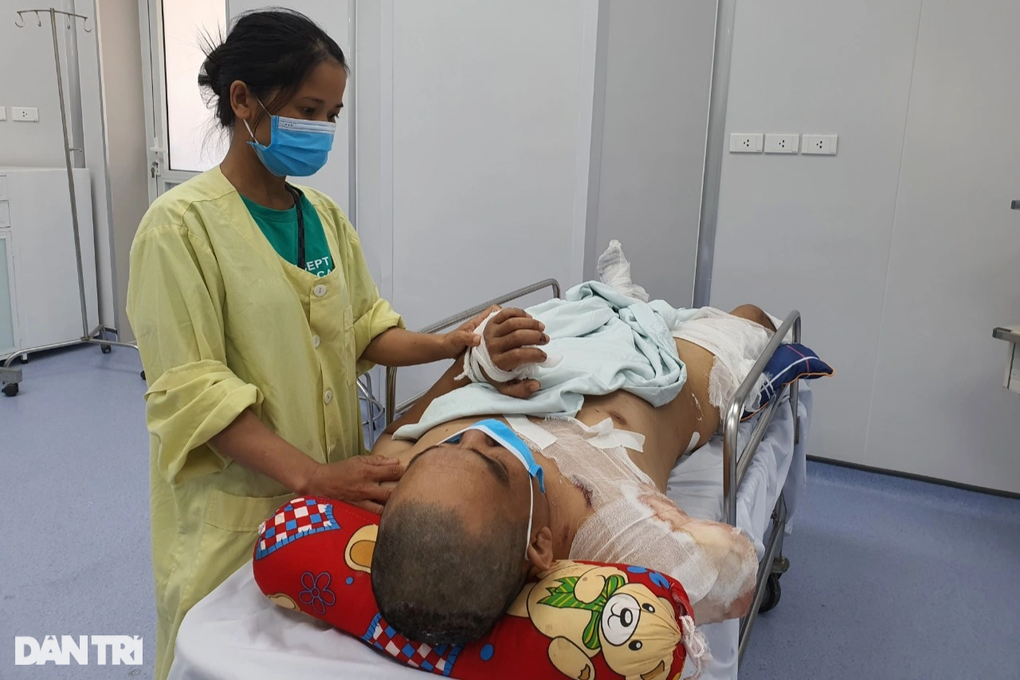 Bỏng điện cao thế, người đàn ông trụ cột gia đình phải cắt cụt tay, chân - 5