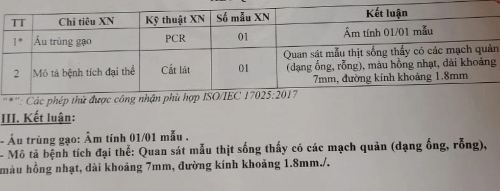 GoGi House bị khách tố có sán trong thịt: Nhà hàng tung kết quả kiểm nghiệm - 2 GoGi House bị khách tố có sán trong thịt: Nhà hàng tung kết quả kiểm nghiệm - 2