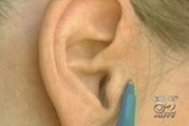 Bị điếc vì... một nụ hôn!