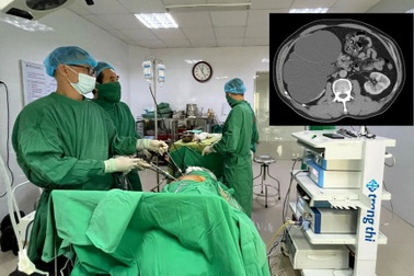 Sai lầm của người đàn ông khiến thận phải phình to như quả bưởi