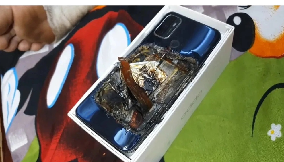Smartphone phát nổ trong túi quần khiến chủ nhân bị thương nặng - 1 Smartphone phát nổ trong túi quần khiến chủ nhân bị thương nặng - 1