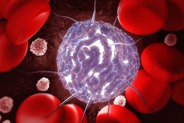 Những điều cần biết về ghép tế bào gốc điều trị ung thư máu