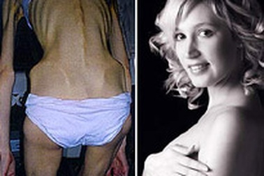 Cuộc hồi sinh kỳ lạ của một phụ nữ 