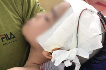 Làm giả chứng nhận cháu bé chấn thương sọ não để quyên tiền từ thiện