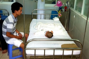 Tai nạn hy hữu, 3 người trong một gia đình bỏng nặng