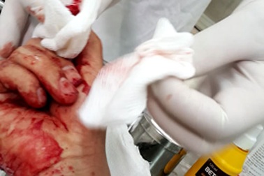 Công an Hà Nội trả lời về vụ việc nhà báo Đỗ Doãn Hoàng bị hành hung