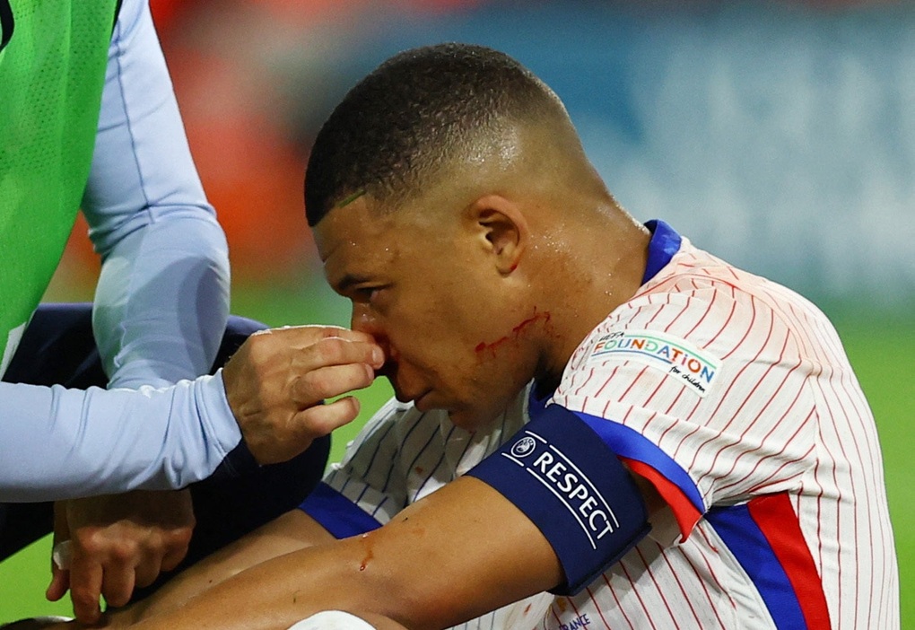 Đội tuyển Pháp đón tin dữ từ Kylian Mbappe - 1 Đội tuyển Pháp đón tin dữ từ Kylian Mbappe - 1