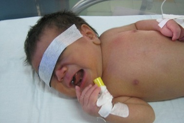 Sức sống mãnh liệt của đứa con bị mẹ bịt miệng
