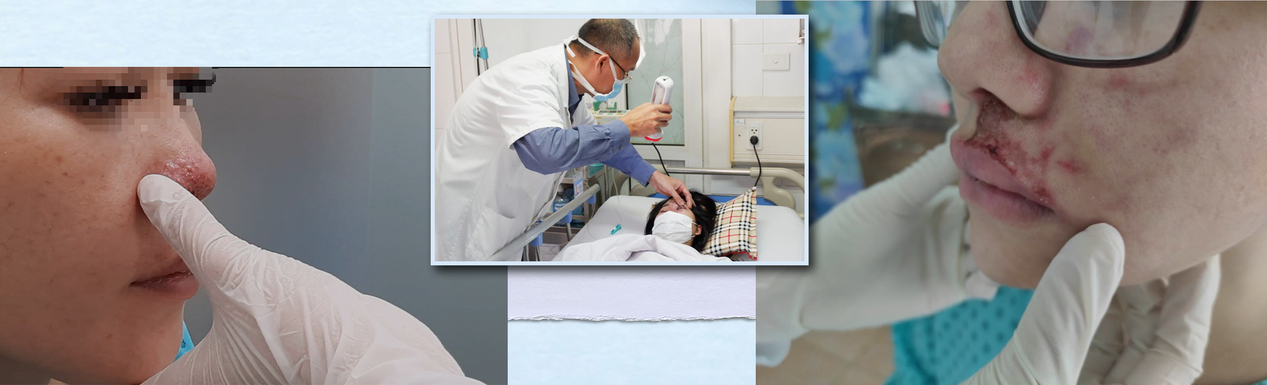 Mù mắt vì tiêm filler: Khi chị em đánh cược vào tiệm tóc, người quen - 9 Mù mắt vì tiêm filler: Khi chị em đánh cược vào tiệm tóc, người quen - 9