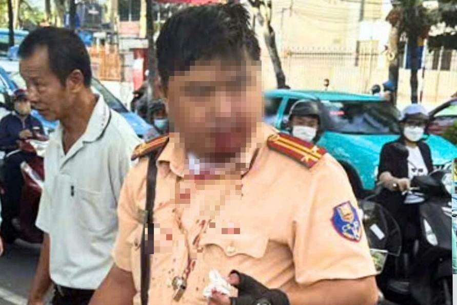 Trung tá CSGT bị người nước ngoài đấm vào mặt khi đang làm nhiệm vụ - 1