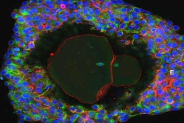 Nuôi trứng trong ống nghiệm – bước đột phá trong điều trị vô sinh