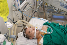 Hà Nội: Hút thuốc lá điện tử, nam sinh tổn thương não phải thở máy