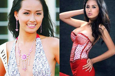 Người đẹp Việt và nghi án "dao kéo" vòng một