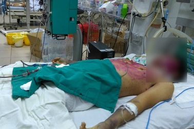 Mẹ bệnh nhân nức nở khóc con khó qua khỏi vì tự ý dùng thuốc chữa thủy đậu