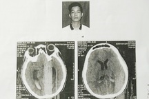 Nam sinh bị đánh chấn thương não: Phục hồi điều tra sau giám định lần 2