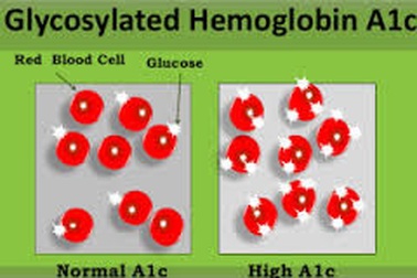 Cách tầm soát đái tháo đường giản tiện?
