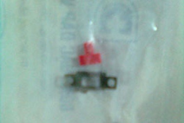 Bé 8 tháng bỏ bú nôn ói vì hóc mảnh vỡ công tắc điện