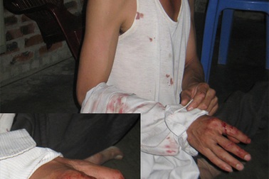 Yêu cầu Công an tỉnh làm rõ vụ người chống tham nhũng bị hành hung