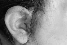 Sở Y tế vào cuộc vụ phụ nữ 64 tuổi gặp biến chứng khi phẫu thuật thẩm mỹ