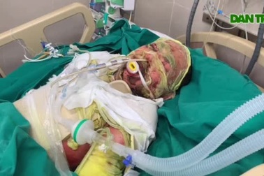 Dị ứng thuốc, tính mạng của cậu bé nguy kịch