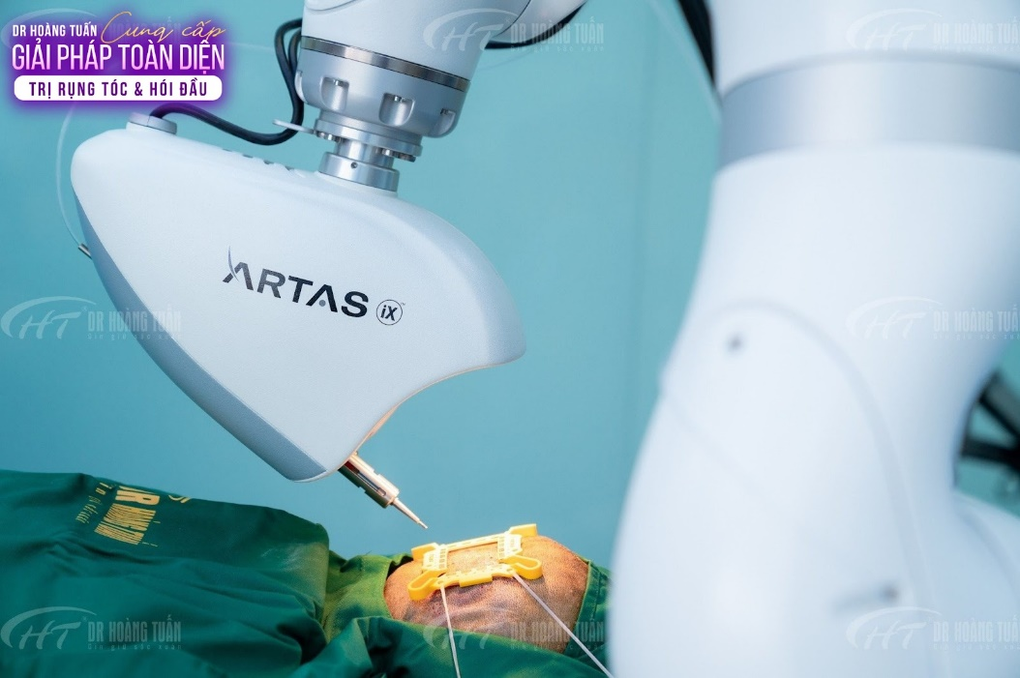 Cấy tóc tự động bằng công nghệ ARTAS® iX - 2 Cấy tóc tự động bằng công nghệ ARTAS® iX - 2