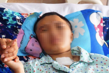 Bác sĩ mổ não 2 lần liên tục, cứu cô gái 23 tuổi "không còn nhiều hy vọng"