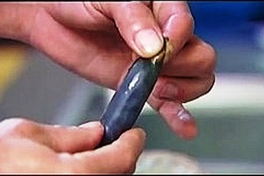 Nuốt mật cá trắm với rượu, người đàn ông ngộ độc phải nhập viện cấp cứu