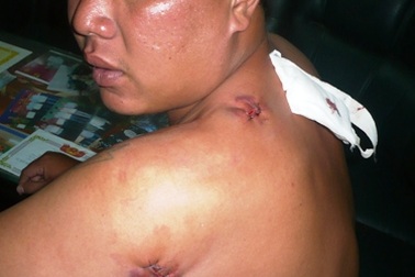 "Hiệp sĩ" máu ướt đẫm người chạy đến cơ quan công an