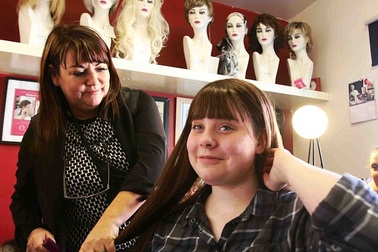 Rụng tóc, tiểu đường vì thuốc trị mụn trứng cá