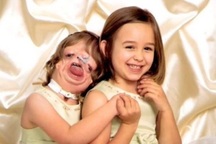 Xúc động hành trình sống sót kỳ diệu của bé gái "không mặt"