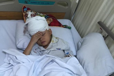 Bệnh viện Hà Thành phẫu thuật miễn phí cho bé bị u hắc tố bẩm sinh diện rộng
