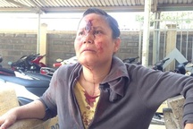 Một phụ nữ bị đánh đổ máu tại trung tâm môi giới việc làm