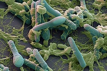 Chất độc có trong pate Minh Chay nguy hiểm như thế nào?