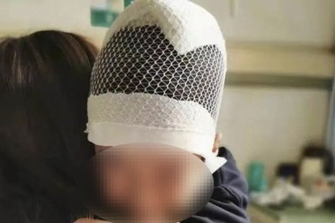 Trung Quốc bắt giữ giáo viên giật tóc làm chấn thương hộp sọ học sinh