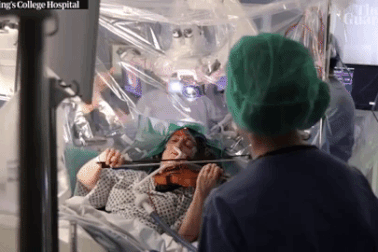Video bệnh nhân chơi vĩ cầm trong lúc bác sĩ phẫu thuật cắt u não