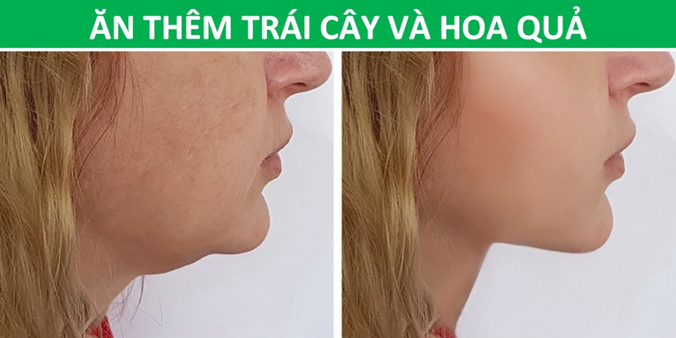Tạm biệt tình trạng béo mặt, nọng cằm từ chính những thói quen hàng ngày - 4 Tạm biệt tình trạng béo mặt, nọng cằm từ chính những thói quen hàng ngày - 4