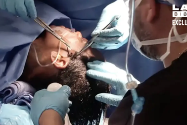 Gái xinh mạng xã hội vào phòng phẫu thuật loại bỏ "keo con voi" khỏi đầu