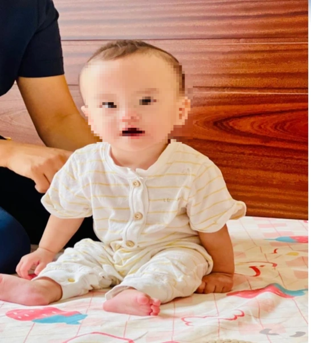 Bé sinh non 400g phát triển như thế nào sau một năm? - 3 Bé sinh non 400g phát triển như thế nào sau một năm? - 3