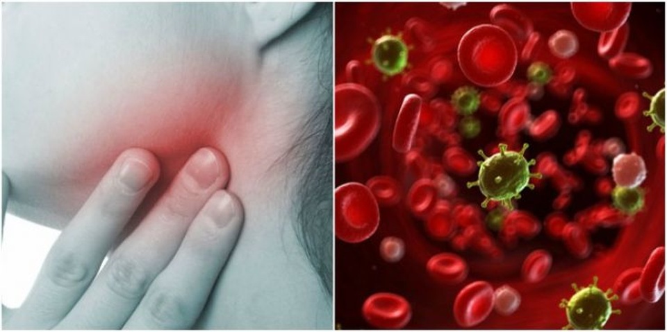 Dấu hiệu cảnh báo ung thư máu nhiều người không ngờ tới - 2 Dấu hiệu cảnh báo ung thư máu nhiều người không ngờ tới - 2