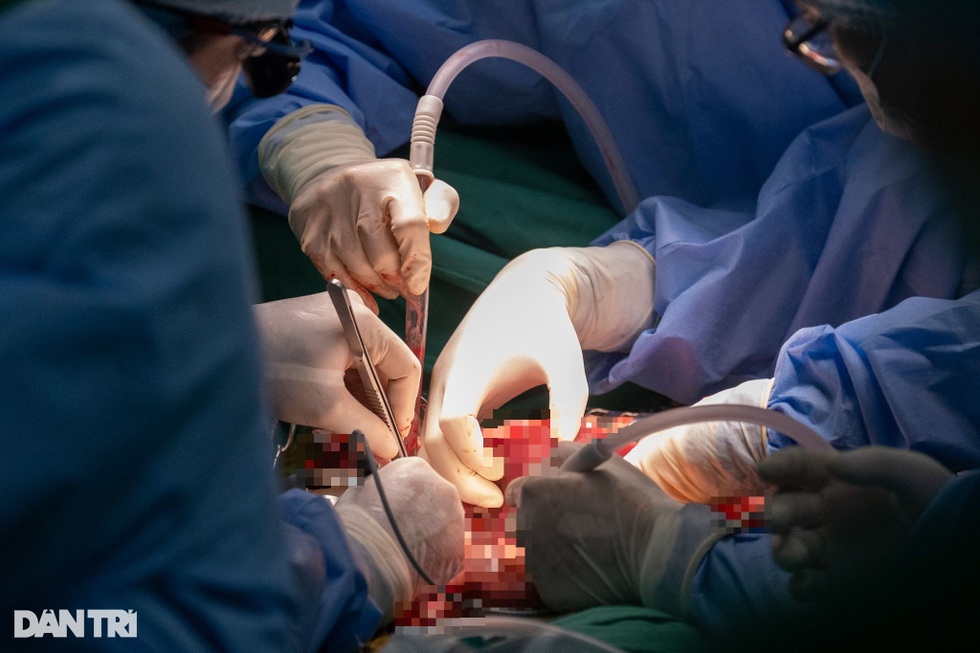 50 năm sau thống nhất, Việt Nam chói sáng trên bản đồ ghép tạng thế giới - 22