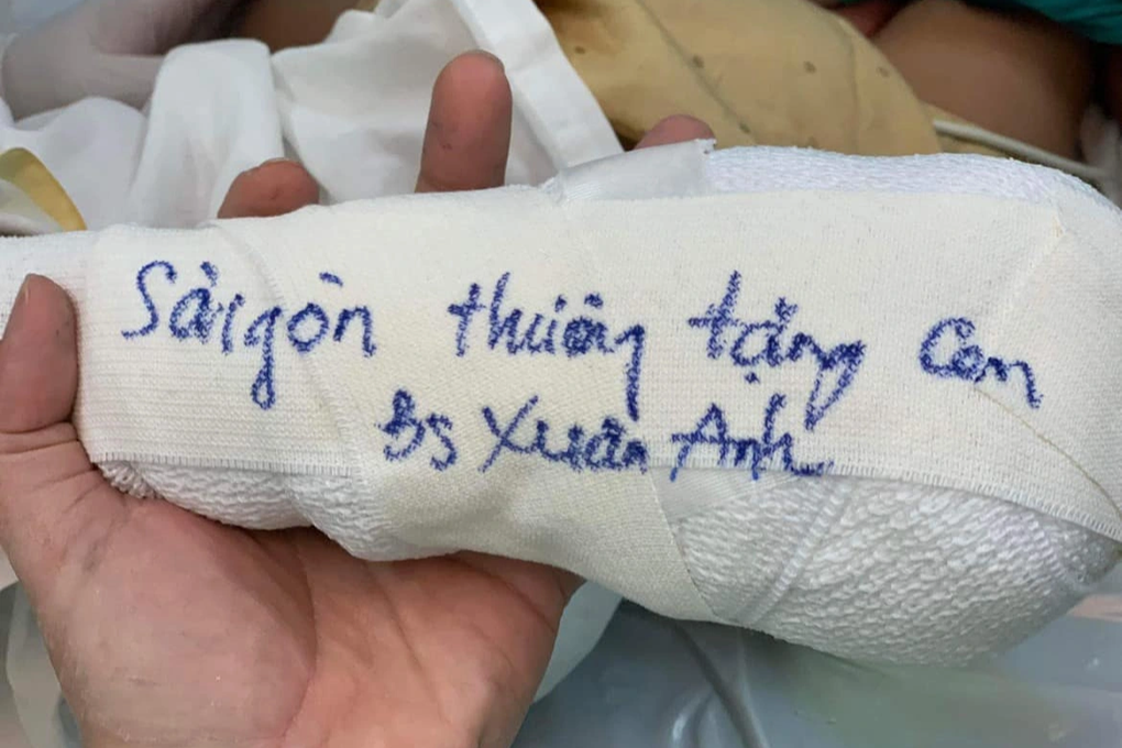 Em bé Hà Giang được bác sĩ TPHCM tặng cả bàn tay - 4 Em bé Hà Giang được bác sĩ TPHCM tặng cả bàn tay - 4