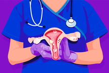 5 biện pháp phòng ngừa ung thư buồng trứng